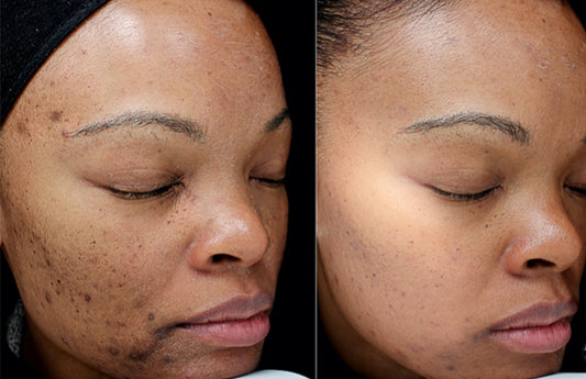 Skin Boot Camp For The Face