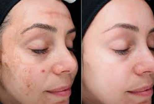 Skin Boot Camp For The Face